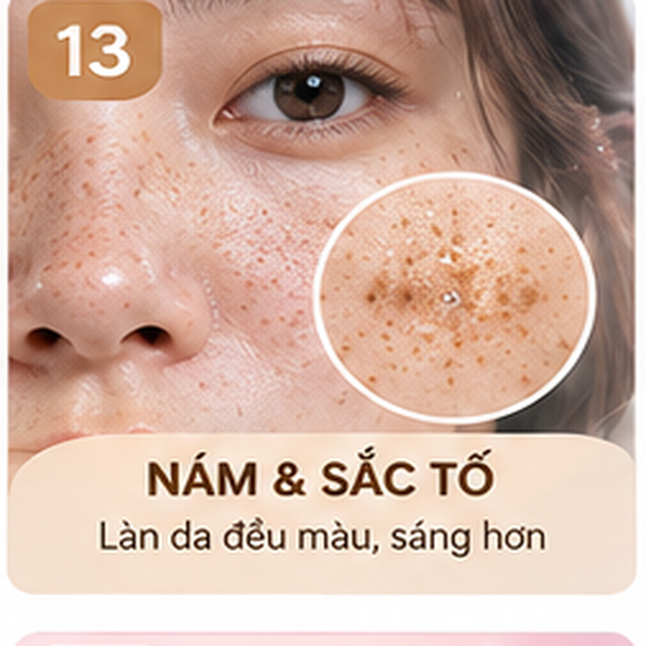 Chăm sóc sắc tố cần sự kiên trì